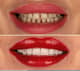 Slider image (10) Dis 212 - Dental Aesthetics Facility